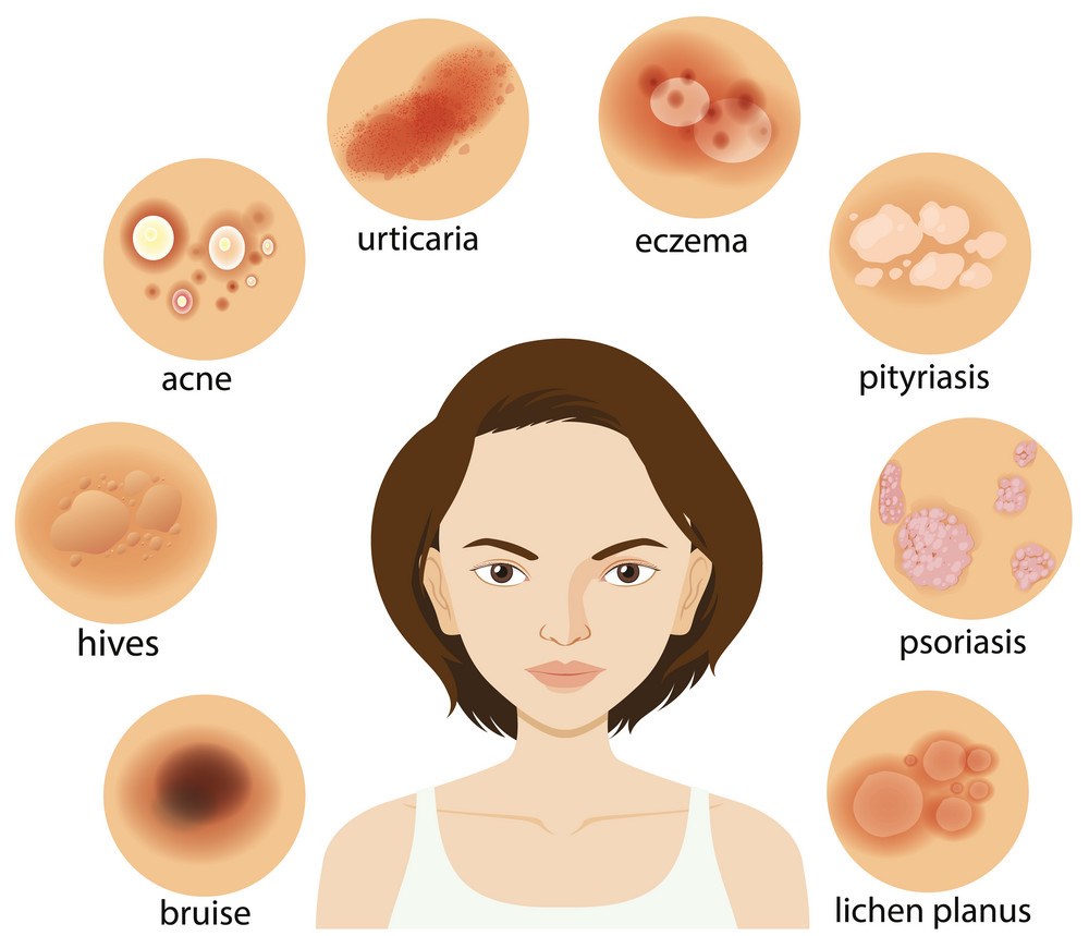 diagram showing different skin conditions vector 27522426